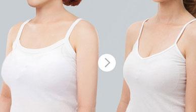 重慶細(xì)胞激光去細(xì)紋治療價(jià)錢一覽表預(yù)覽(重慶三峽中心醫(yī)院頜面外科細(xì)胞激光去細(xì)紋參考價(jià)：3209元)