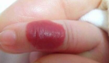 貴陽耳朵整形價格