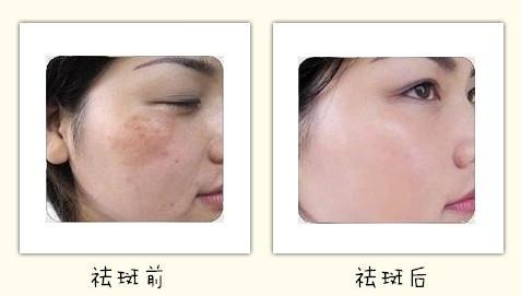 廣州鼻缺損治療價格表收費(廣州唯人昱美醫(yī)療美容診所鼻缺損治療參考價：5090元)