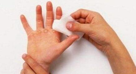 揚(yáng)州韓式精致雙眼皮價(jià)格