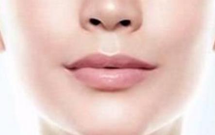 深圳攣縮鼻修復(fù)需要花費(fèi)治療費(fèi)用多少(深圳大學(xué)總醫(yī)院整形美容科攣縮鼻修復(fù)參考價：4824元)