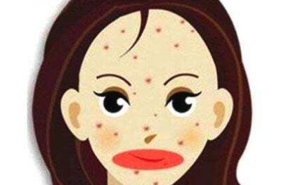 杭州去除細紋皺紋2023價格表查詢(杭州伊佳整形醫(yī)院去除細紋皺紋參考價：4170元)