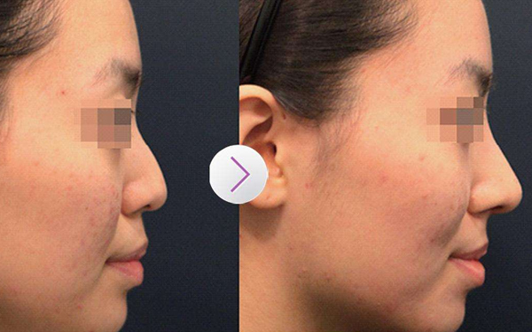 四川e光美白嫩膚治療價(jià)格表呈現(xiàn)(四川米蘭柏羽醫(yī)學(xué)美容醫(yī)院e光美白嫩膚參考價(jià)：5060元)