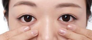 南寧微針祛妊娠紋一次需要價(jià)格是多少啊(2023南寧微針祛妊娠紋參考價(jià)為：5282元)