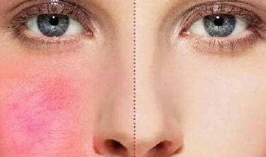 鞍山6F精雕吸脂的價(jià)位明細(xì)一覽(2023鞍山6F精雕吸脂參考價(jià)為：7404元)