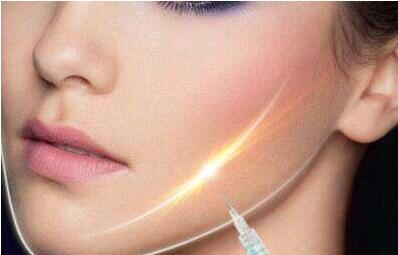 杭州埋線提升眼角紋大約市場價(jià)格是多少(2023杭州埋線提升眼角紋參考價(jià)為：6405元)