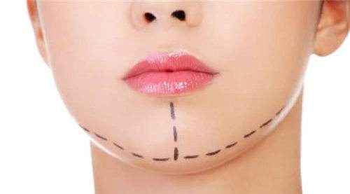 沈陽(yáng)眼袋注射溶脂針價(jià)格