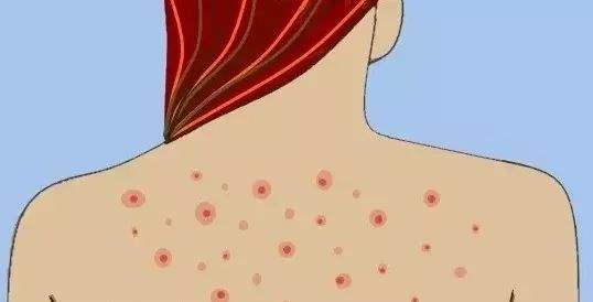 南昌腰腹環(huán)吸填充臀部收費(fèi)價(jià)目表反饋(2023南昌腰腹環(huán)吸填充臀部參考價(jià)為：6680元)