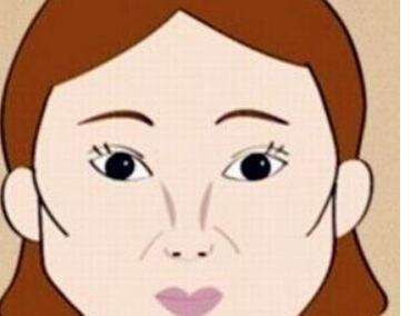 廣州重度鼻翼缺損修復(fù)整形價(jià)格清單公布(2023廣州重度鼻翼缺損修復(fù)參考價(jià)為：7185元)