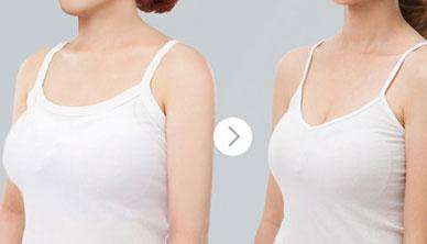 新疆膠原蛋白豐額頭2023費用詳情一覽(2023新疆膠原蛋白豐額頭參考價為：6584元)