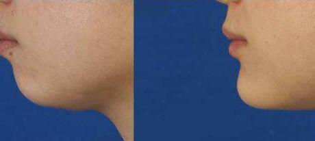 重慶無影刀2023價格表全新展示(2023重慶無影刀參考價為：6633元)