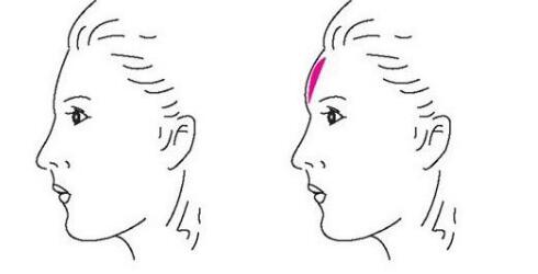 宜賓隆鼻失敗修復(fù)整形整形價(jià)格信息公布(2023宜賓隆鼻失敗修復(fù)整形參考價(jià)為：7546元)