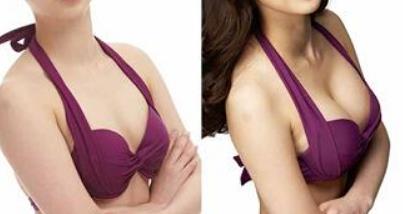 南昌腹部光纖吸脂報(bào)價(jià)治療費(fèi)用(2023南昌腹部光纖吸脂參考價(jià)為：6598元)