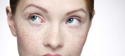 廣州玻尿酸祛疤痕價格多不多(2023廣州玻尿酸祛疤痕參考價為：6390元)