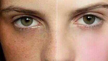 上饒麥格膨體隆胸2023報(bào)價(jià)詳情一覽(上饒維多利亞醫(yī)療美容麥格膨體隆胸參考價(jià)：5630元)