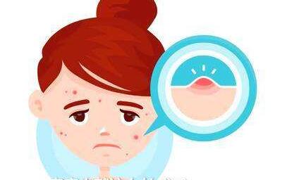 鐵嶺嗨體填充下巴的價(jià)錢查詢(2023鐵嶺嗨體填充下巴參考價(jià)為：7066元)