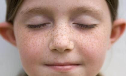 佛山激光鐳射祛黃褐斑價格