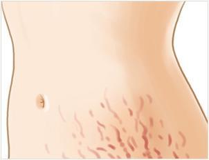 杭州肉毒素去面部細紋整形價目表查看(2023杭州肉毒素去面部細紋參考價為：6581元)