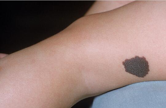 遼寧全顏面微創(chuàng)除皺術(shù)價格是多少啊(2023遼寧全顏面微創(chuàng)除皺術(shù)參考價為：5981元)