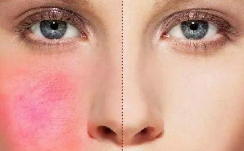 鐵嶺生物注射除皺整形價(jià)格大概多少錢(2023鐵嶺生物注射除皺參考價(jià)為：7276元)