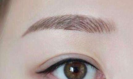 紹興眼紋激光去除費用更新發(fā)布(2023紹興眼紋激光去除參考價為：7148元)