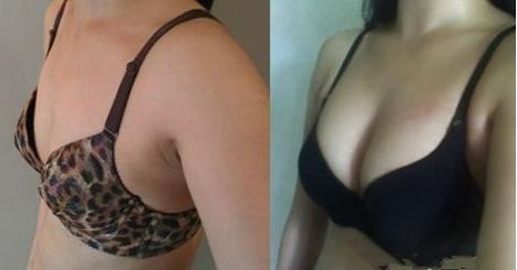 上海美雕祛痘印的價錢一般要多少錢啊(2023上海美雕祛痘印參考價為：6457元)