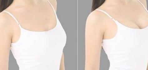 貴州水光針祛黑眼圈的費(fèi)用大概要多少錢合理(2023貴州水光針祛黑眼圈參考價(jià)為：5866元)