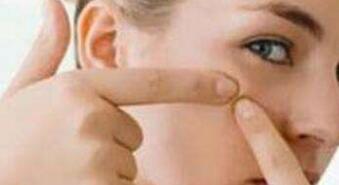 東莞筋膜提拉價格