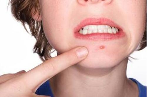 上海脂肪填充前額價位表同步一覽(2023上海脂肪填充前額參考價為：7103元)