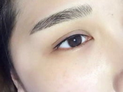 上海美式隆胸治療價格優(yōu)惠來襲(2023上海美式隆胸參考價為：5557元)