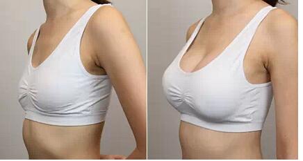 北京自體脂肪干細(xì)胞豐胸價(jià)格