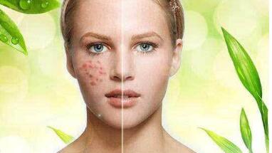 杭州手術(shù)改善眼細(xì)紋價(jià)格明細(xì)表(2023杭州手術(shù)改善眼細(xì)紋參考價(jià)為：6734元)