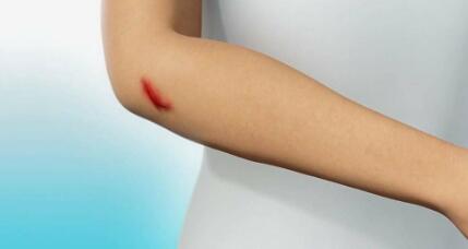 衡陽多維美雕隆鼻價格表2023全新參考詳情(衡陽中心醫(yī)院多維美雕隆鼻參考價：3819元)