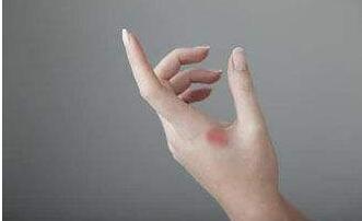 南京曼特波隆下巴費用大約多少錢(2023南京曼特波隆下巴參考價為：6820元)