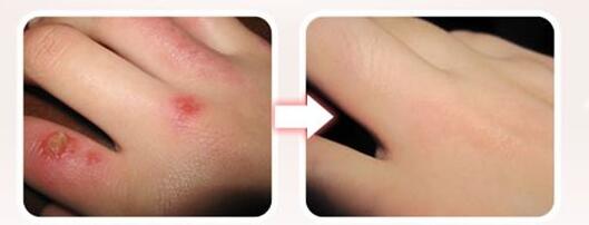 鄭州隆鼻綜合2023價(jià)格(2023鄭州隆鼻綜合參考價(jià)為：6451元)