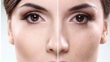 菏澤乳頭肥大價格