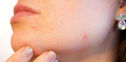 呼和浩特超皮秒去唇紋價(jià)目趨勢(shì)圖流出(2023呼和浩特超皮秒去唇紋參考價(jià)為：5986元)