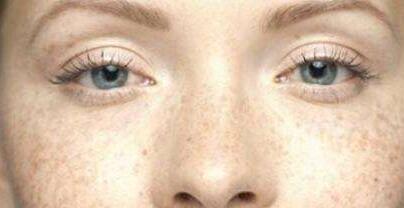 廣州玻尿酸注射豐額頭手術(shù)費(fèi)用震撼發(fā)布(2023廣州玻尿酸注射豐額頭參考價(jià)為：6311元)