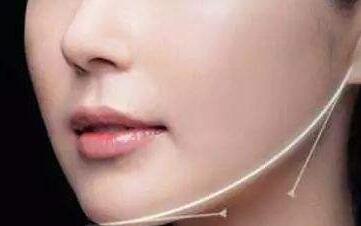 合肥乳頭凹陷矯正2023價(jià)格表線上公布(2023合肥乳頭凹陷矯正參考價(jià)為：6158元)