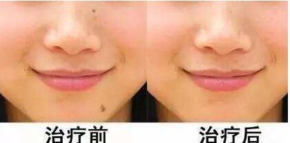 河南無痛瘦腿吸脂手術(shù)費(fèi)用趨勢(shì)圖查看(2023河南無痛瘦腿吸脂手術(shù)參考價(jià)為：6554元)