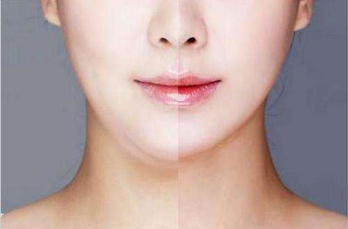 安徽微晶祛痘印收費標準明細一覽(2023安徽微晶祛痘印參考價為：6053元)