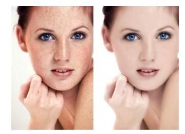 贛州川字紋線雕提升大概市場(chǎng)價(jià)格參考(2023贛州川字紋線雕提升參考價(jià)為：5729元)