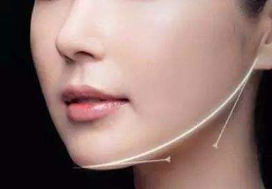 北京去妊娠紋手術(shù)費(fèi)用為多少(2023北京去妊娠紋手術(shù)參考價(jià)為：6941元)