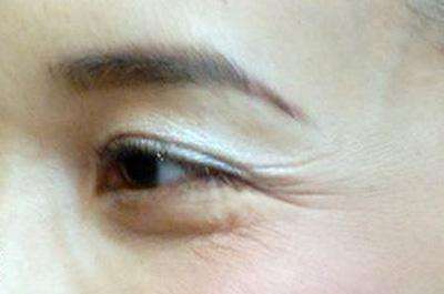 恩施光子溶脂瘦腰腹收費(fèi)價(jià)目圖表上線(2023恩施光子溶脂瘦腰腹參考價(jià)為：7210元)