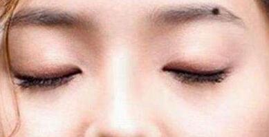 上海自體脂肪移植除皺治療價(jià)格清單上線(2023上海自體脂肪移植除皺參考價(jià)為：5481元)