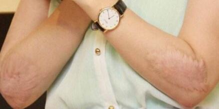 上海韓式吸脂瘦身手術費用一覽表明細(2023上海韓式吸脂瘦身參考價為：7440元)