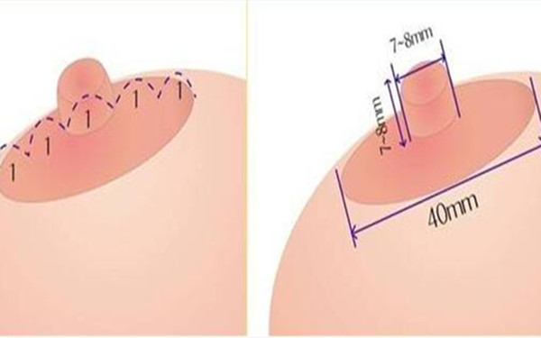 武漢提拉細(xì)紋的價(jià)格全新公開(2023武漢提拉細(xì)紋參考價(jià)為：6105元)