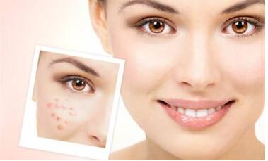 寧波韓式祛眼袋整形手術(shù)的報價查詢?nèi)缦?2023寧波韓式祛眼袋整形手術(shù)參考價為：6788元)