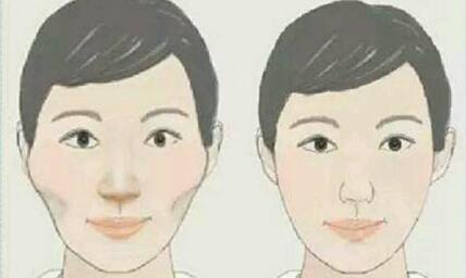 ?？邳S金膠原微針2023價(jià)目表強(qiáng)勢(shì)來(lái)襲(2023?？邳S金膠原微針參考價(jià)為：7079元)