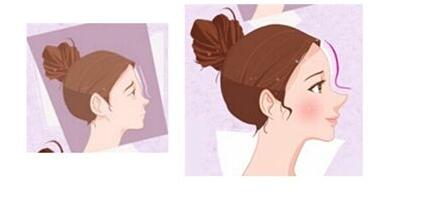 嘉興膠原蛋白去靜態(tài)紋價格表項目收費詳情(2023嘉興膠原蛋白去靜態(tài)紋參考價為：6313元)